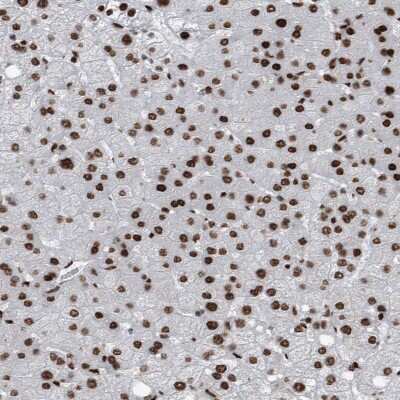 Immunohistochemistry-Paraffin: DNMT3A Antibody [NBP1-85961]