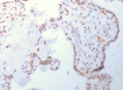 Immunohistochemistry-Paraffin: DNMT3A Antibody (PCRP-DNMT3A-1E2) [NBP3-07672]