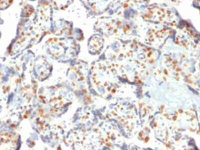 Immunohistochemistry-Paraffin: DNMT3A Antibody (PCRP-DNMT3A-1E2) - Azide and BSA Free [NBP3-08483]