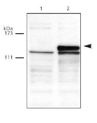 Western Blot: DNMT3A Antibody [NB100-265]