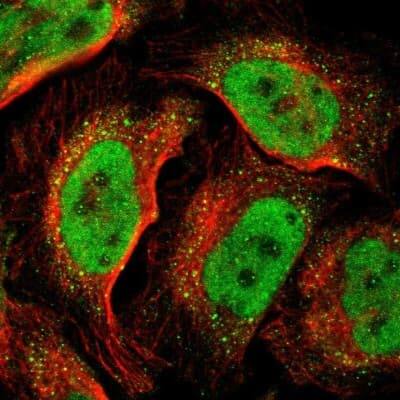 Immunocytochemistry/ Immunofluorescence: DNMT3B Antibody [NBP1-85815]