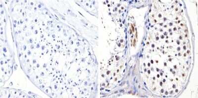 Immunohistochemistry-Paraffin: DNMT3B Antibody [NB300-516]