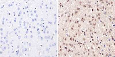 Immunohistochemistry-Paraffin: DNMT3B Antibody [NB300-516]