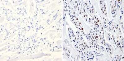 Immunohistochemistry-Paraffin: DNMT3B Antibody [NB300-516]