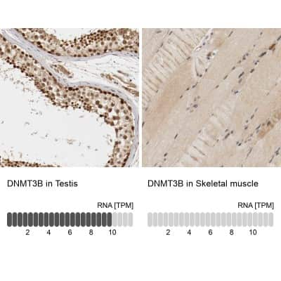 Immunohistochemistry-Paraffin: DNMT3B Antibody [NBP1-85815]