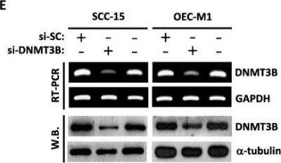 Knockdown Validated: DNMT3B Antibody [NB300-516]