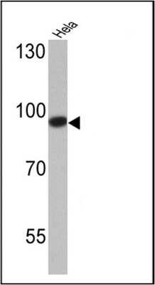 Simple Western: DNMT3B Antibody [NB300-516]