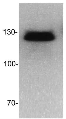 Western Blot: DNMT3B Antibody [NB300-516]
