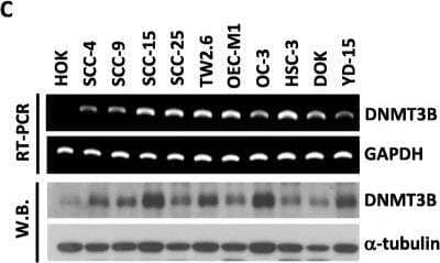 Western Blot: DNMT3B Antibody [NB300-516]