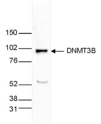 Western Blot: DNMT3B Antibody [NBP2-59291]