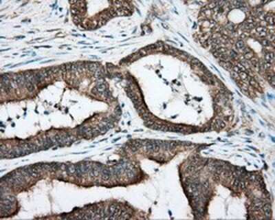 Immunohistochemistry: DNTTIP1 Antibody (OTI1F4) - Azide and BSA Free [NBP2-72352]