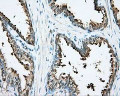 Immunohistochemistry: DNTTIP1 Antibody (OTI1F4) - Azide and BSA Free [NBP2-72352]