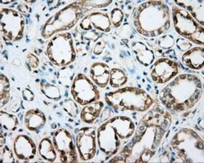 Immunohistochemistry: DNTTIP1 Antibody (OTI1F4) - Azide and BSA Free [NBP2-72352]