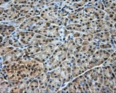 Immunohistochemistry: DNTTIP1 Antibody (OTI1F4) - Azide and BSA Free [NBP2-72352]