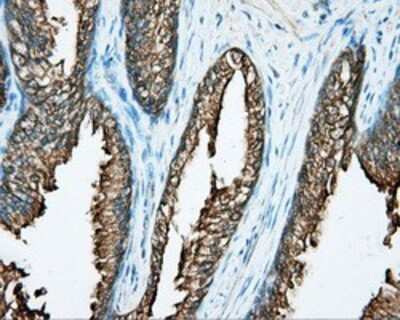 Immunohistochemistry: DNTTIP1 Antibody (OTI1F4) - Azide and BSA Free [NBP2-72352]