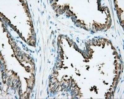Immunohistochemistry-Paraffin: DNTTIP1 Antibody (OTI1F4) [NBP2-02507]
