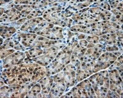 Immunohistochemistry-Paraffin: DNTTIP1 Antibody (OTI1F4) [NBP2-02507]