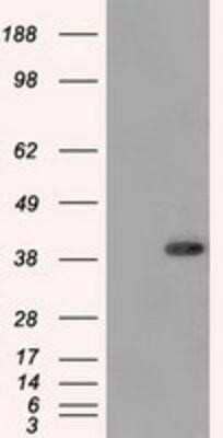 Western Blot: DNTTIP1 Antibody (OTI1F4) [NBP2-02507]