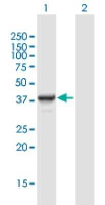 Western Blot: DNTTIP1 Antibody [H00116092-B01P]