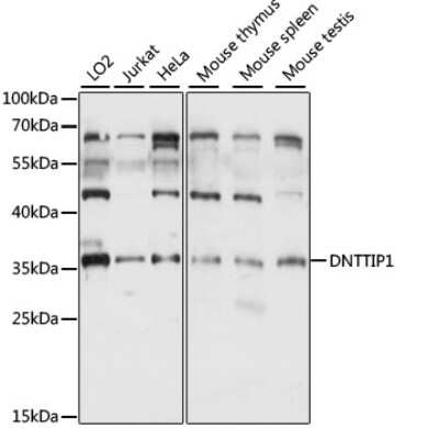 Western Blot: DNTTIP1 AntibodyAzide and BSA Free [NBP2-92249]