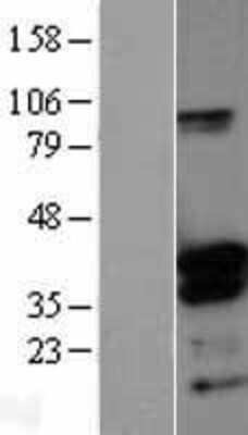 Western Blot: DNTTIP1 Overexpression Lysate [NBL1-09975]