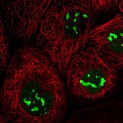 Immunocytochemistry/ Immunofluorescence: DNTTIP2 Antibody [NBP1-91845]