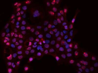 Immunocytochemistry/ Immunofluorescence: DNTTIP2 Antibody [NBP2-97758]