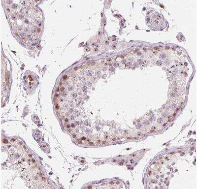 Immunohistochemistry-Paraffin: DNTTIP2 Antibody [NBP1-91845]