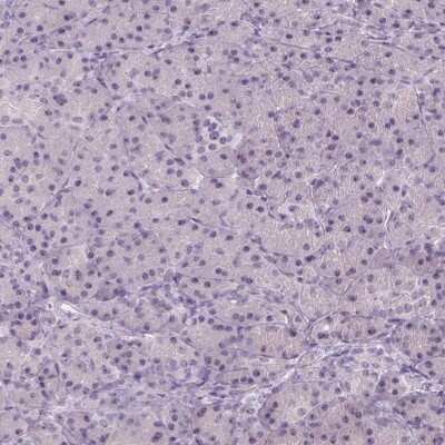 Immunohistochemistry-Paraffin: DNTTIP2 Antibody [NBP2-38710]