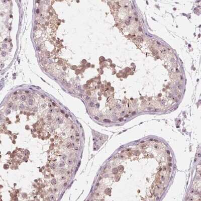 Immunohistochemistry-Paraffin: DNTTIP2 Antibody [NBP2-38710]