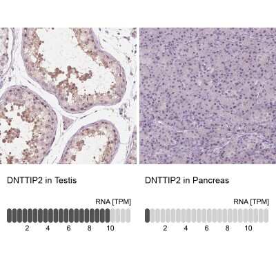 Immunohistochemistry-Paraffin: DNTTIP2 Antibody [NBP2-38710]