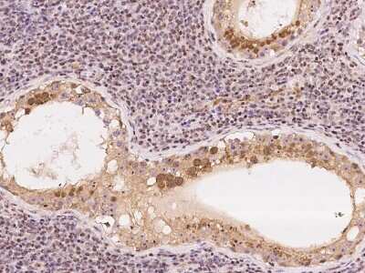 Immunohistochemistry-Paraffin: DNTTIP2 Antibody [NBP2-97758]