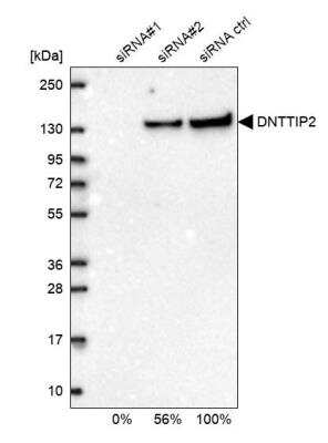 Western Blot: DNTTIP2 Antibody [NBP1-91845]