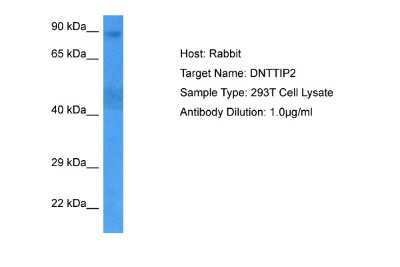 Western Blot: DNTTIP2 Antibody [NBP2-84809]