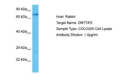 Western Blot: DNTTIP2 Antibody [NBP2-84810]