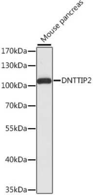 Western Blot: DNTTIP2 AntibodyAzide and BSA Free [NBP2-92296]