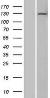 Western Blot: DNTTIP2 Overexpression Lysate [NBP2-07310]