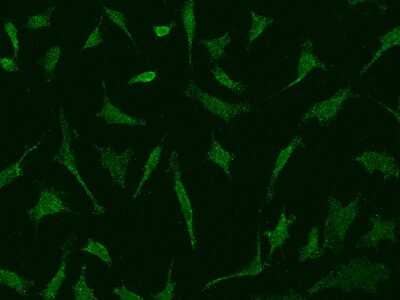 Immunocytochemistry/ Immunofluorescence: DNase II Antibody [NBP2-97515]