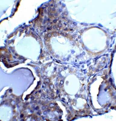 Immunohistochemistry: DNase II Antibody - BSA Free [NBP1-76971]