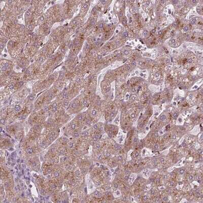 Immunohistochemistry: DNase II Antibody [NBP2-39068]