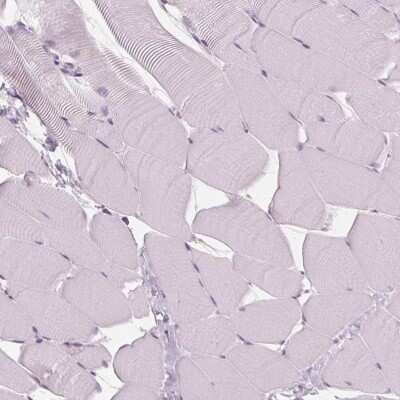 Immunohistochemistry-Paraffin: DNase II Antibody [NBP2-39068]