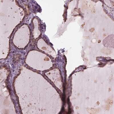 Immunohistochemistry-Paraffin: DNase II Antibody [NBP2-39068]