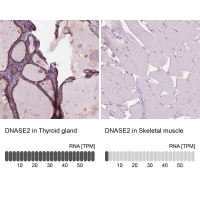 Immunohistochemistry-Paraffin: DNase II Antibody [NBP2-39068]