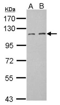 Western Blot: DOC1 Antibody [NBP2-16208]