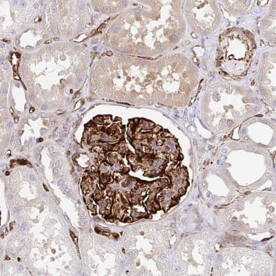 Immunohistochemistry: DOCK1 Antibody [NBP2-38586]