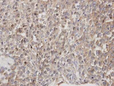 Immunohistochemistry-Paraffin: DOCK1 Antibody [NBP1-30945]