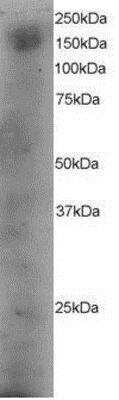 Western Blot: DOCK1 Antibody [NB100-828]