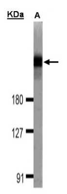 Western Blot: DOCK1 Antibody [NBP1-30945]