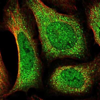 Immunocytochemistry/ Immunofluorescence: DOCK10 Antibody [NBP2-58637]