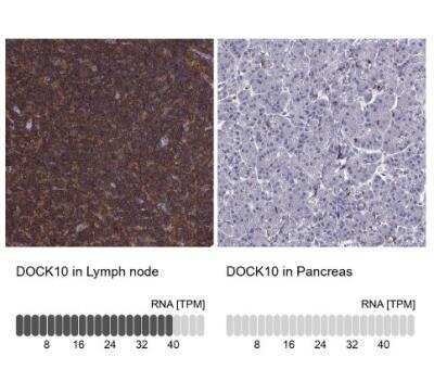 Immunohistochemistry-Paraffin: DOCK10 Antibody [NBP2-58637]